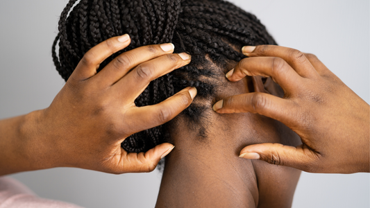 Why Healthy Curls Start with a Healthy Scalp